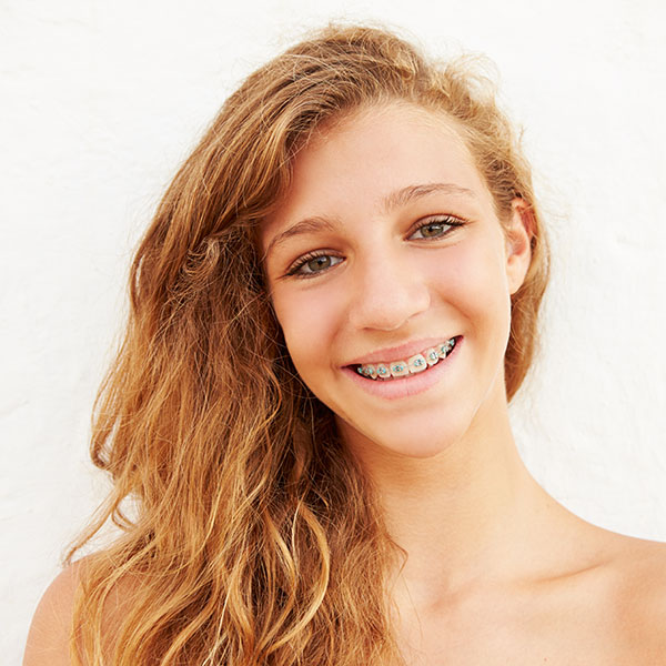 Invisalign Clear Aligners in West Vancouver